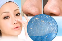 Bí quyết trị tận gốc mụn đầu đen