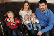 Thương tâm gia đình 3 con bị bệnh não hiếm gặp