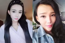 10 mỹ nhân biến thành yêu quái vì phẫu thuật thẩm mỹ