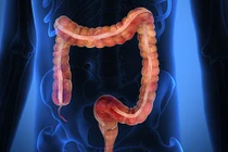 Lý do bạn nên tẩy ruột thường xuyên