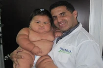 Kỳ lạ bé 10 tháng nặng như bé 5 tuổi