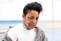 Mẹ trẻ nát bươm mặt vì máy xay sinh tố nổ tung