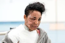 Mẹ trẻ nát bươm mặt vì máy xay sinh tố nổ tung