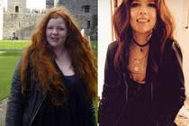 Ung thư trầm trọng vì giảm cân đột ngột