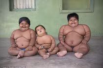 Bi đát cha phải bán thận điều trị béo phì cho con