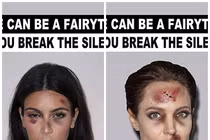 Ảnh gây sốc của các ngôi sao bị bạo lực gia đình