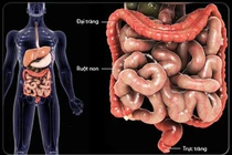 Làm gì để không bị ung thư đại tràng như vua nhạc sến?
