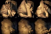 Cận cảnh hình ảnh thai nhi của bà mẹ hút thuốc