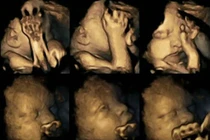 Cận cảnh hình ảnh thai nhi của bà mẹ hút thuốc