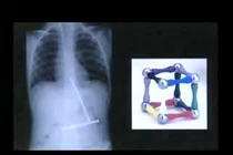 Xem những vật thể kỳ dị trong cơ thể người