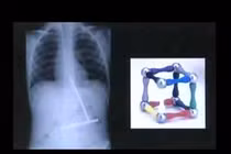 Xem những vật thể kỳ dị trong cơ thể người