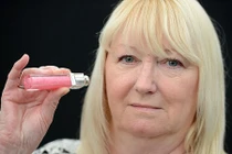 Bỏng môi, loét da kinh hoàng vì dị ứng son Dior Addict