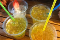 10 nguyên nhân gây sỏi thận không thể tin nổi