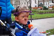 Bé 7 tuổi can đảm chịu 50 lần phẫu thuật não