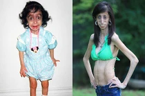 Nghị lực khủng khiếp của cô gái xấu nhất hành tinh