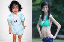 Nghị lực khủng khiếp của cô gái xấu nhất hành tinh