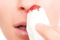 9 dấu hiệu phát hiện sớm bệnh ung thư máu