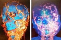 Tận mục ca phẫu thuật phức tạp nhất thế giới