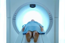 5 loại xét nghiệm cấp thiết để phát hiện sớm ung thư