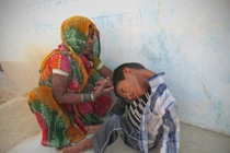 Cậu bé mắc bệnh hiếm gặp không thể nâng thẳng cổ 