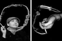 Tận mục thuốc lá đi vào vòm họng gây ung thư