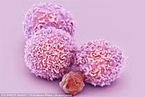 Lý giải một số ung thư di căn nhanh nguy hiểm