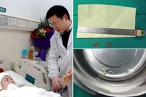 Phát hiện sán dài 10cm “làm tổ” trong não thiếu nữ