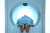 Những điều cần chuẩn bị khi có chẩn đoán ung thư