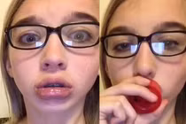 Trào lưu hít chai để môi sưng vù như Kylie Jender