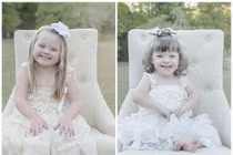 Sửng sốt ngắm nụ cười tuyệt đẹp của các bé bệnh Down