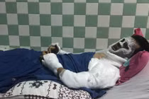 Vụ Việt kiều bị tạt axit: Bộ Công an vào cuộc quyết bắt thủ phạm