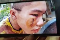 Sự thật quan hệ giữa thiếu nữ 22 tuổi với sư ở Tịnh thất Bồng Lai?