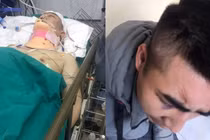 Lái xe Phòng Cảnh sát Hình sự gặp TNGT, gia đình nghi bị chém