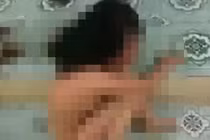 Nữ sinh lớp 9 bị nhóm bạn lột quần áo, đánh hội đồng phải nhập viện