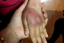 Các cơ quan chức năng vào cuộc vụ bé gái 8 tuổi bị bố đẻ bạo hành