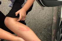 Đình chỉ giảng dạy 6 tháng cô giáo Hải Phòng tát học sinh tiểu học