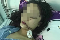 Nguyên nhân 2 thiếu nữ rạch mặt nhau kinh hoàng ở Bắc Ninh