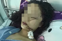 Nguyên nhân 2 thiếu nữ rạch mặt nhau kinh hoàng ở Bắc Ninh