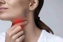Cảm giác nghẹn ở họng có thể cảnh báo bệnh nghiêm trọng