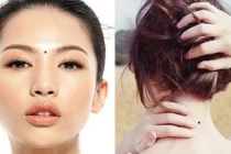 3 nốt ruồi “tụ tài” ai có được lộc lá quanh năm, 2 vị trí phá tài 