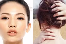 3 nốt ruồi “tụ tài” ai có được lộc lá quanh năm, 2 vị trí phá tài 