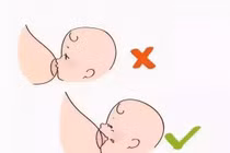 Đây mới là nguyên nhân thực sự khiến ngực chảy xệ