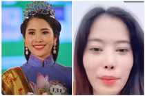 Nam Em lần đầu thừa nhận 'thẩm mỹ hỏng' một điểm trên gương mặt