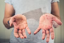 Người lớn có thể mắc bệnh tay chân miệng không?