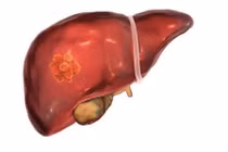 Người đàn ông chỉ uống nước mỗi sáng suốt 22 năm qua đời 