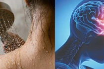 Thời tiết nắng nóng, tắm đêm, tắm lạnh đột ngột có gây ra đột quỵ?