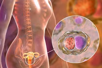 Dấu hiệu bệnh ung thư phổ biến ngửi thấy được