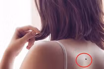 4 nốt ruồi thiên kim, phụ nữ chỉ cần 1 là mang mệnh phượng hoàng