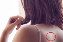 4 nốt ruồi thiên kim, phụ nữ chỉ cần 1 là mang mệnh phượng hoàng