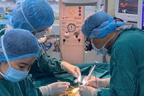 Bộ Y tế lên tiếng việc nhiều viện 'kêu' thiếu thuốc chống đông, nguy cơ phải ngưng mổ tim